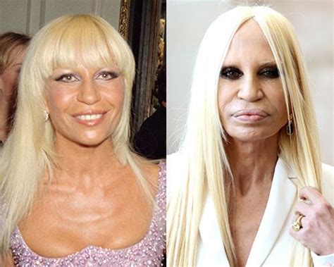 fashion designer plastic surgery.